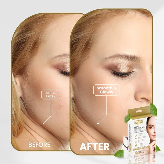 Facial Hair Remover for Women – Gentle & Painless Removal for Peach Fuzz, Lip & Chin